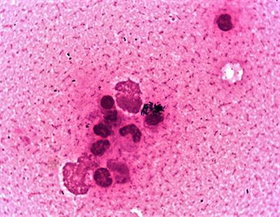 Case Report: Toxigenic Corynebacterium ulcerans Diphtheria-Like Infection in a Horse in the United Kingdom